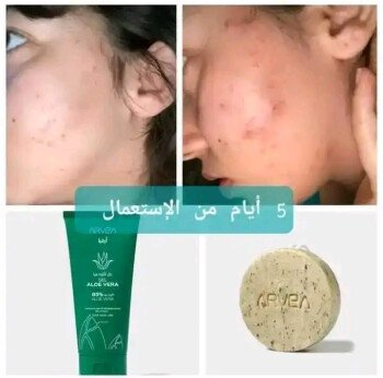 شركة  أرفيــا للصحة والجمال