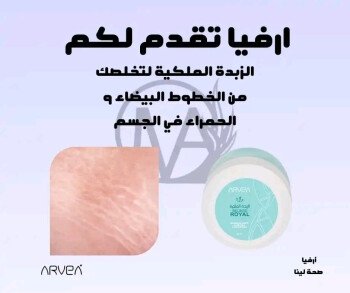 شركة  أرفيــا للصحة والجمال