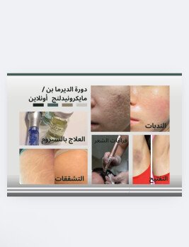 مايكرو ستور