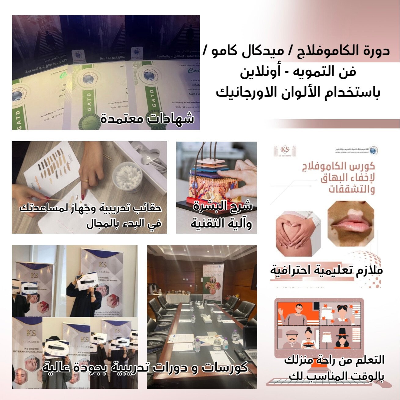 مايكرو ستور