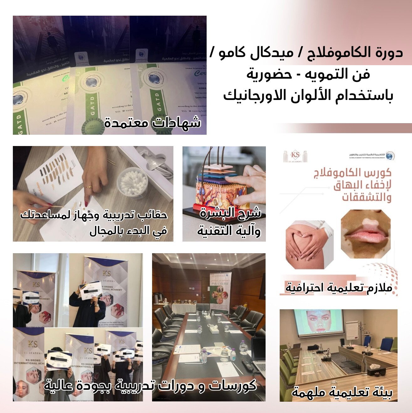 مايكرو ستور