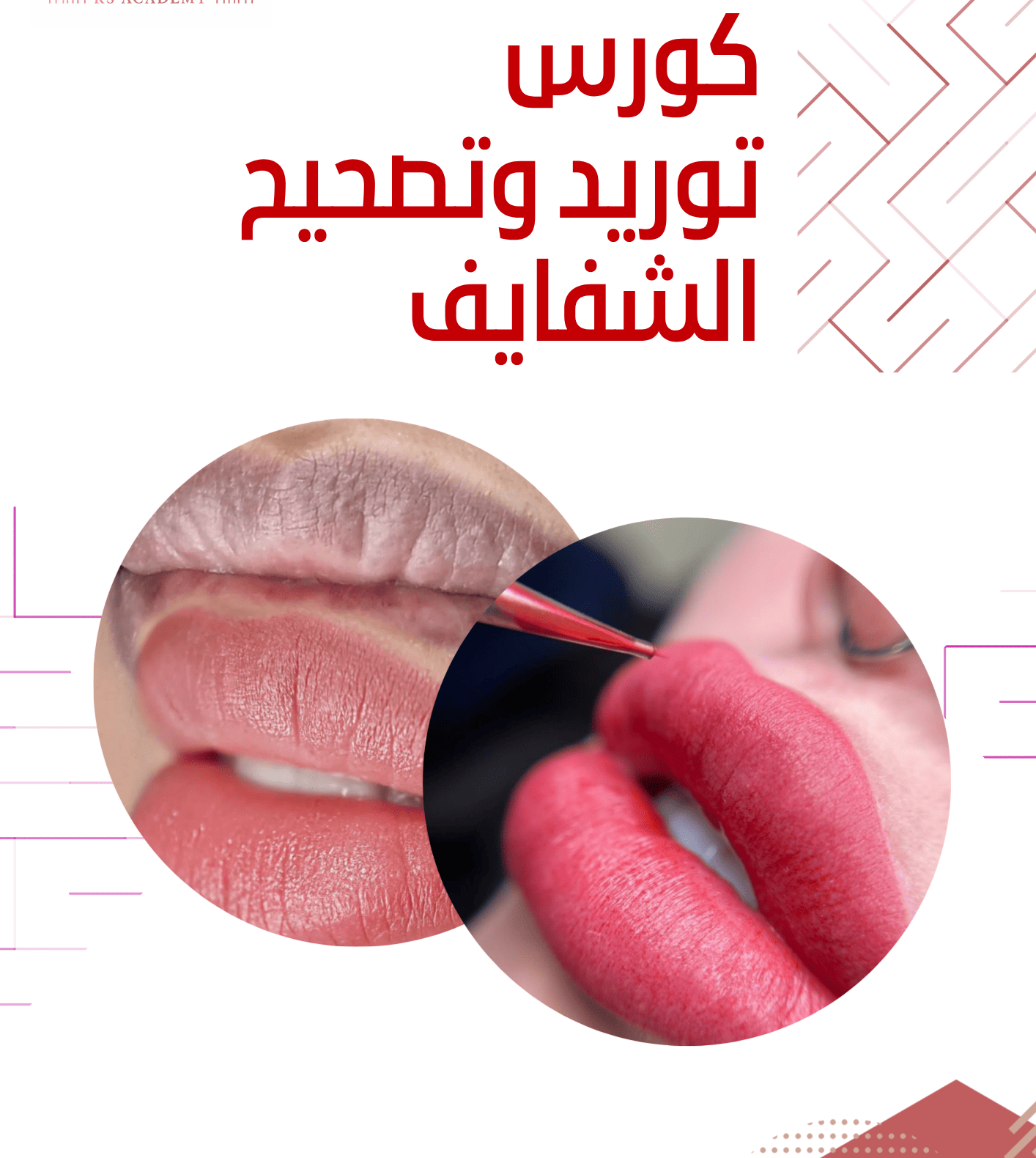 مايكرو ستور